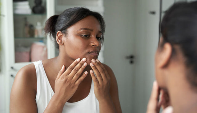 Hoe salicylzuur helpt om acné te voorkomen
