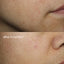 Vitamin C⁺ Serum